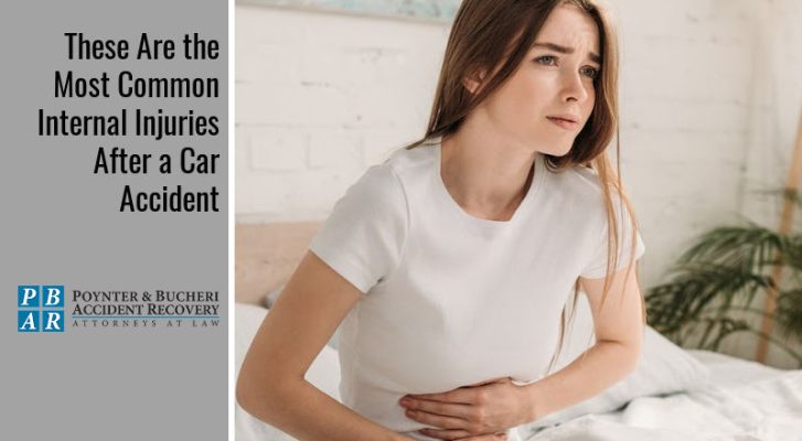 These Are the Most Common Internal Injuries After a Car Accident