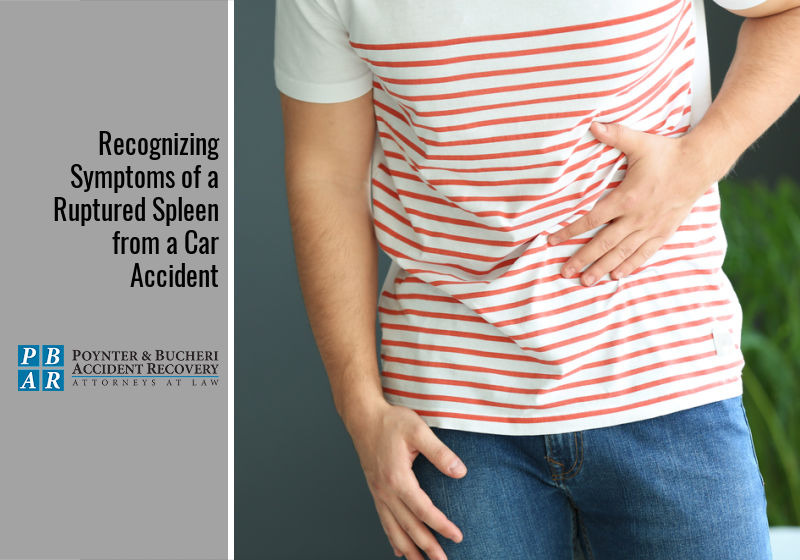 Recognizing Symptoms of a Ruptured Spleen from a Car Accident
