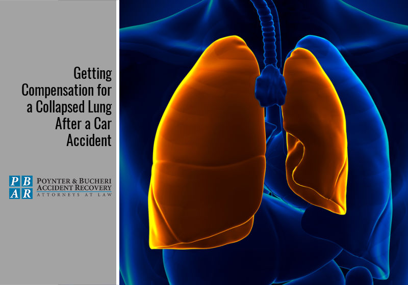 Getting Compensation for a Collapsed Lung After a Car Accident