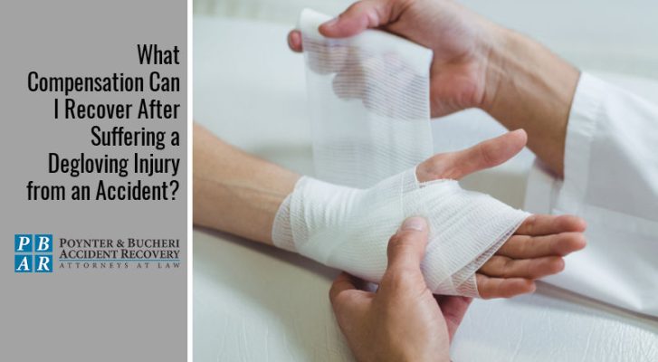 What Compensation Can I Recover After Suffering a Degloving Injury from an Accident?