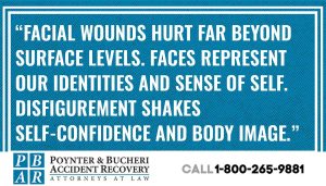 Car Accident Face Injuries
