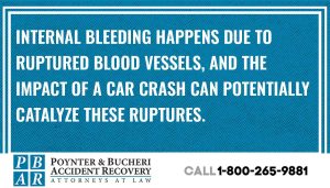 Symptoms Of Internal Bleeding After A Car Accident		
		
		
		