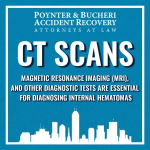 ct scans