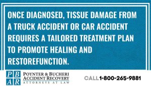 truck accident tissue damage		
		
		
		