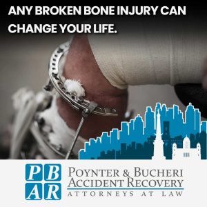 broken bone lawyer