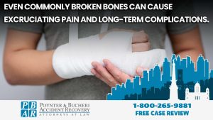 common broken bones