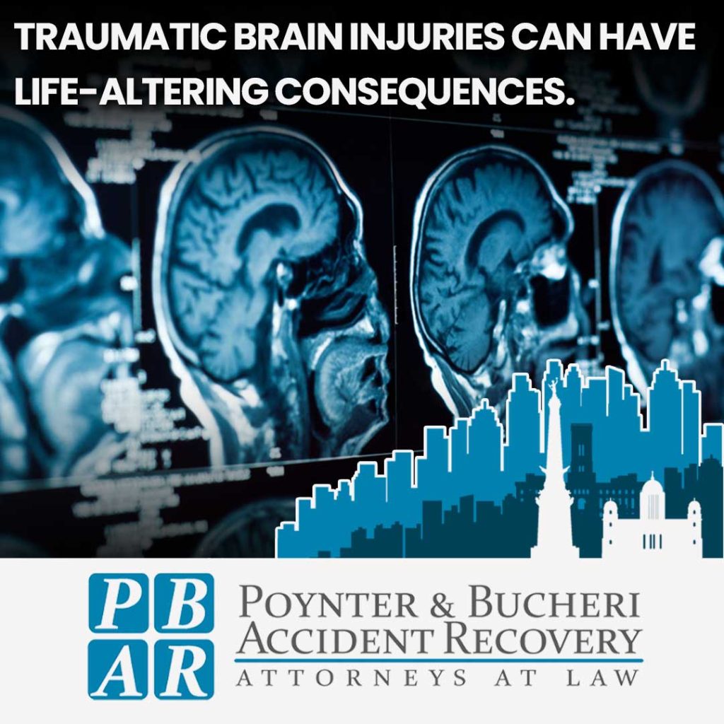 PB Greenfield personal injury attorneys brain injuries