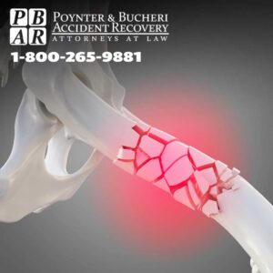 bone crush image