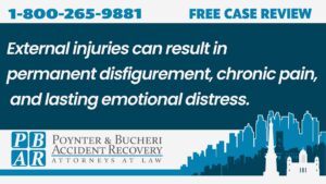 external injuries